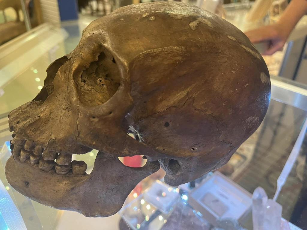 Human Skull and jawbone sitting on a glass display case.